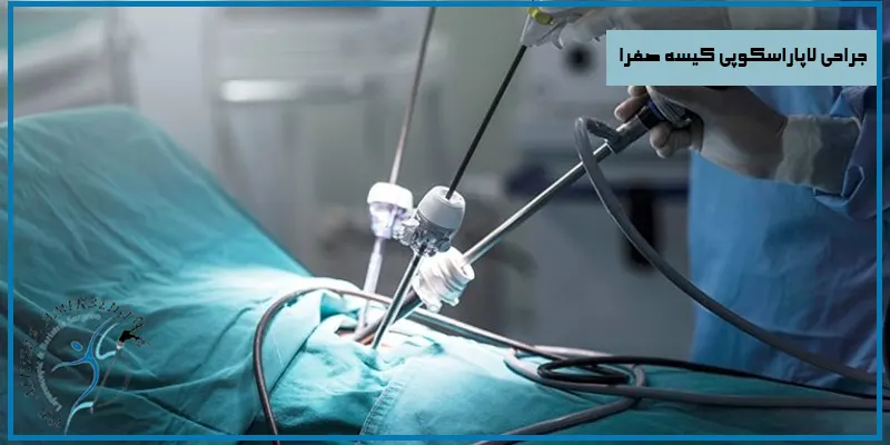 جراحی-لاپاراسکوپی-کیسه-صفرا-و-مجاری-صفراوی