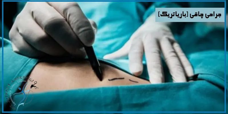 جراحی-چاقی