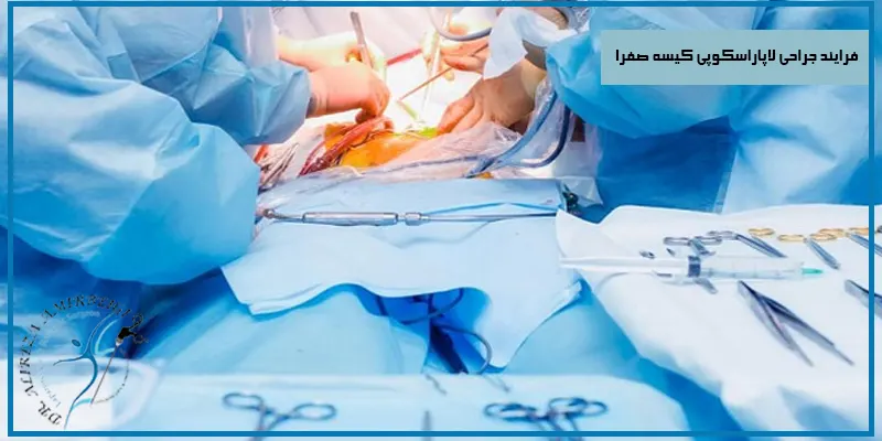 فرایند-جراحی-لاپاراسکوپی-کیسه-صفرا