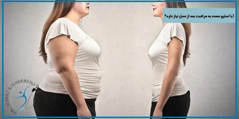 آیا-اسلیو-معده-به-مراقبت-بعد-از-عمل-نیاز-دارد؟