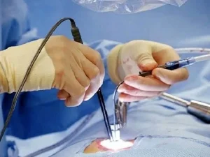 جراحی لاپاراسکوپی