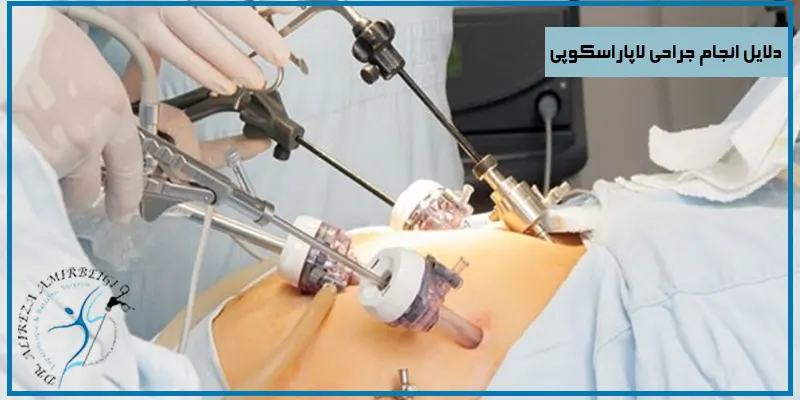 دلایل-انجام-جراحی-لاپاراسکوپی