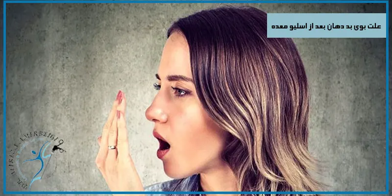 علت-بوی-بد-دهان-بعد-از-اسلیو-معده