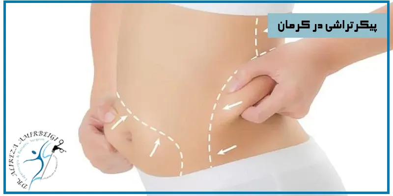 پیکرتراشی-در-کرمان