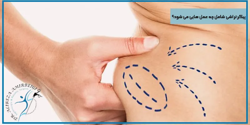 پیکرتراشی-شامل-چه-عمل-هایی-می-شود؟