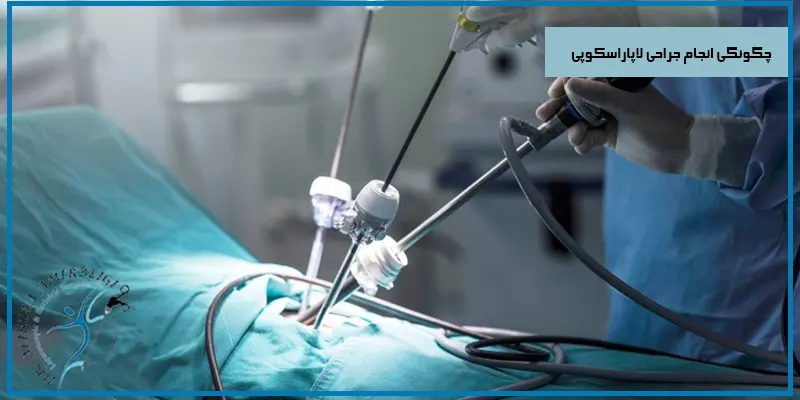 چگونگی-انجام-جراحی-لاپاراسکوپی