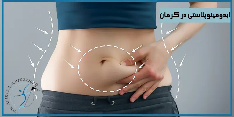 ابدومینوپلاستی-در-کرمان