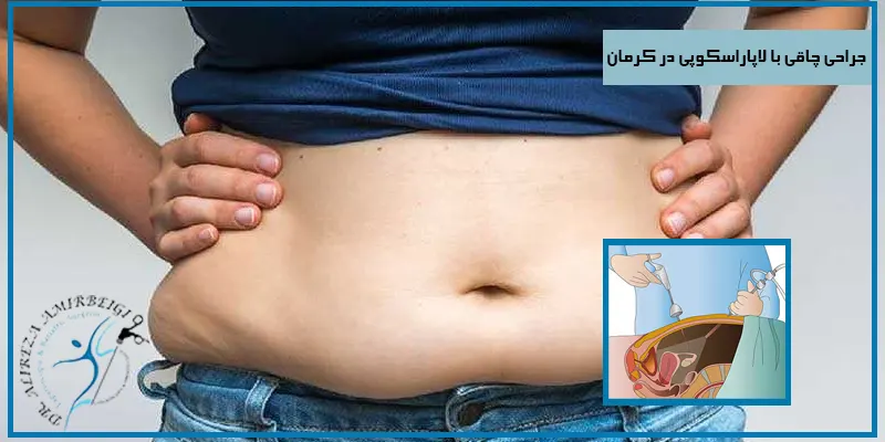 جراحی-چاقی-با-لاپاراسکوپی-در-کرمان