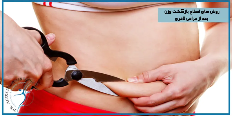 روش-های-اصلاح-بازگشت-وزن-بعد-از-جراحی-لاغری