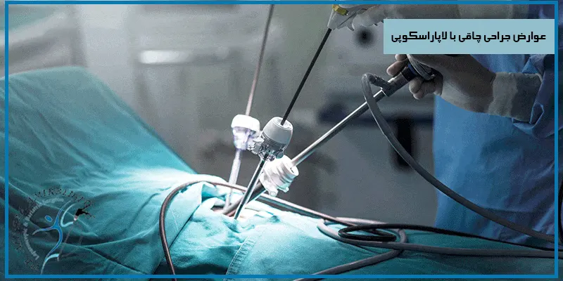 عوارض-جراحی-چاقی-با-لاپاراسکوپی