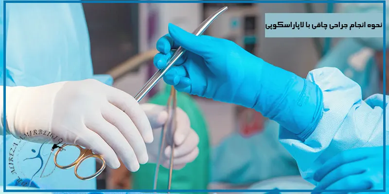 نحوه-انجام-جراحی-چاقی-با-لاپاراسکوپی
