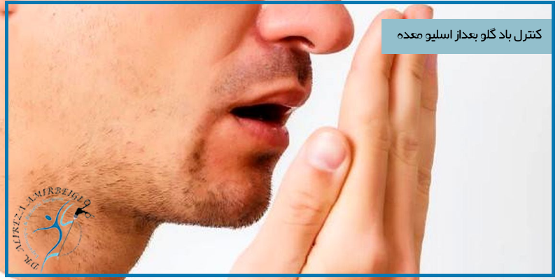 کنترل باد گلو بعد از اسلیو معده