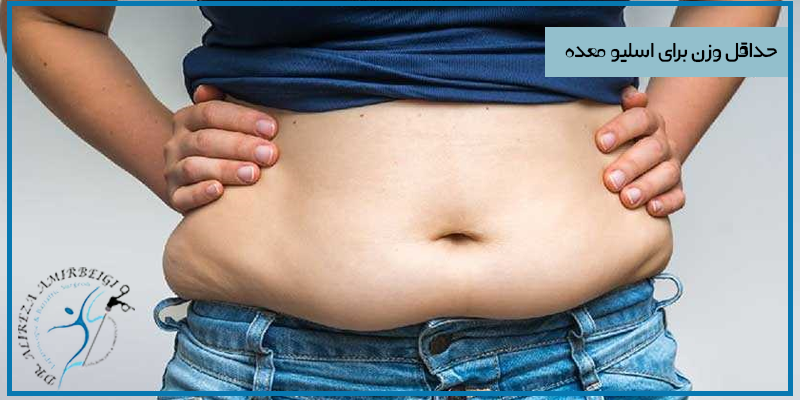 حداقل وزن برای اسلیو معده