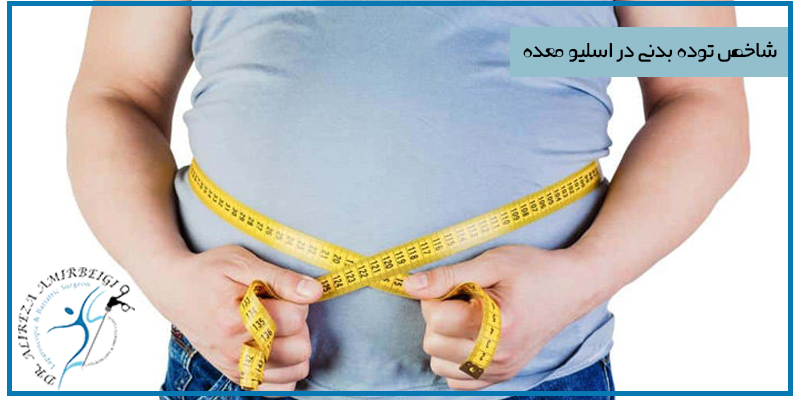 شاخص توده بدنی در اسلیو معده 