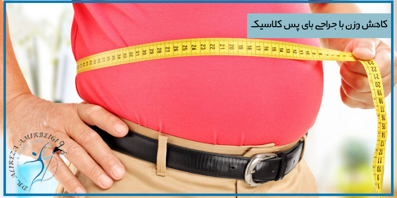 با انجام جراحی بای پس کلاسیک چقدر وزن کم می کنم؟