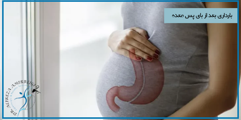 بارداری بعد از بای پس معده