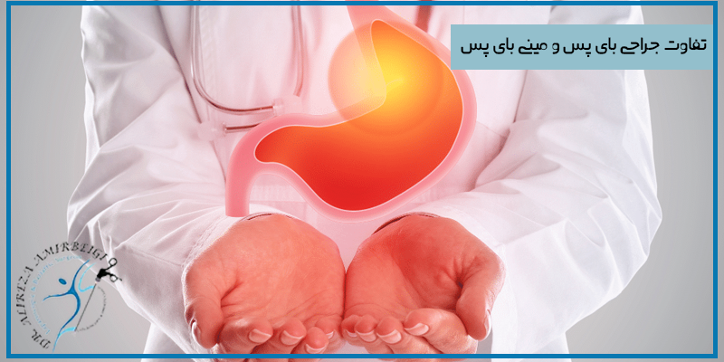 تفاوت عمل بای پس و مینی بای پس