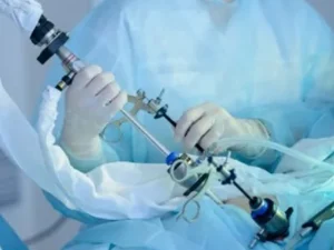 عوارض جراحی کیسه صفرا را جدی بگیرید!