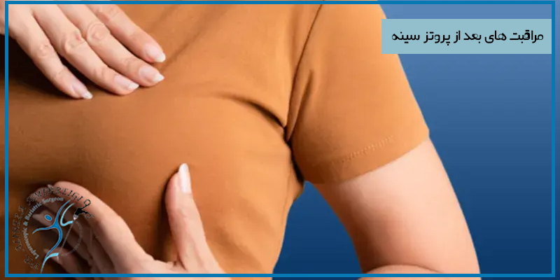 مراقبت های بعد از پروتز سینه 