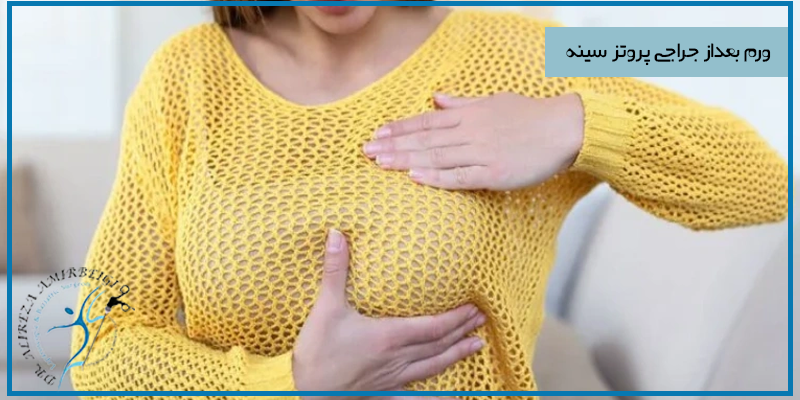 آیا داشتن ورم بعد از پروتز سینه طبیعی است؟