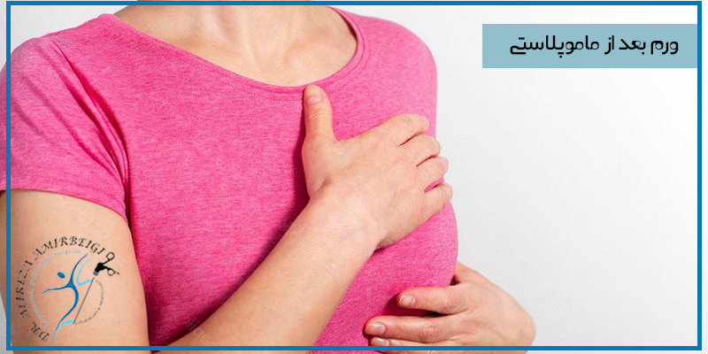 دلایل ورم سینه بعد از ماموپلاستی